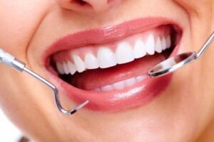 Dental patient during dental cleanings and x-rays in Long Beach, CA