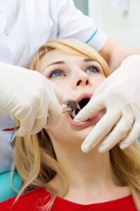 Young woman during wisdom teeth removal in Long Beach, CA