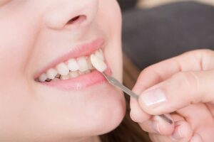 Woman having porcelain veneers procedure in Long Beach, CA